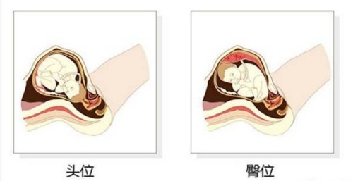 子宫肌瘤可以吃燕窝吗？燕窝的滋补作用很大